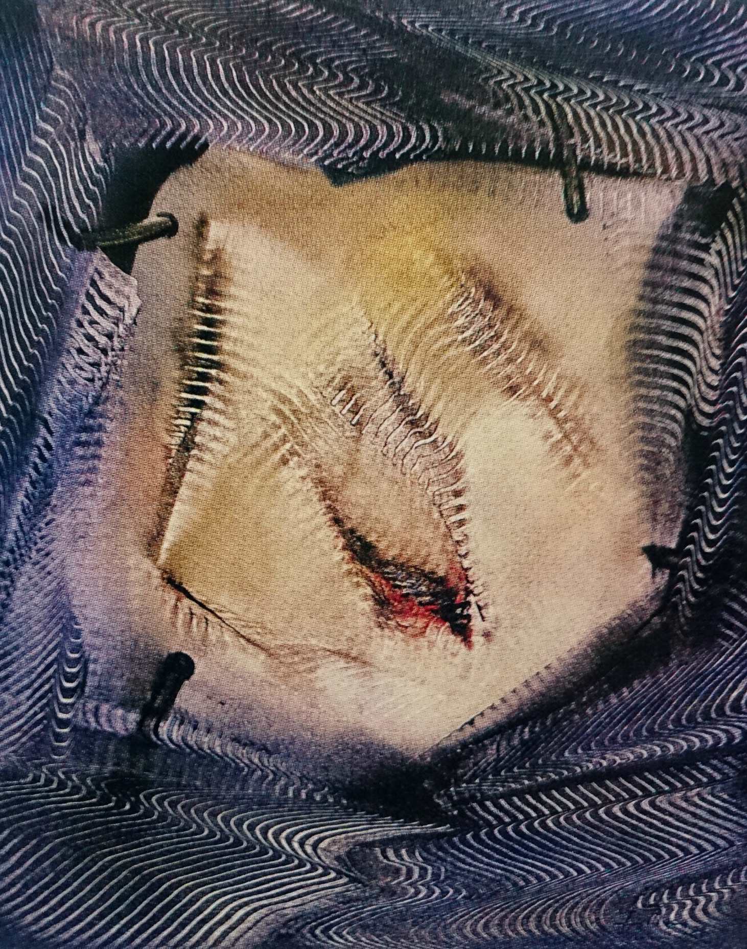 Blog LaPlaca_Herida_SerieCaprichos_1988